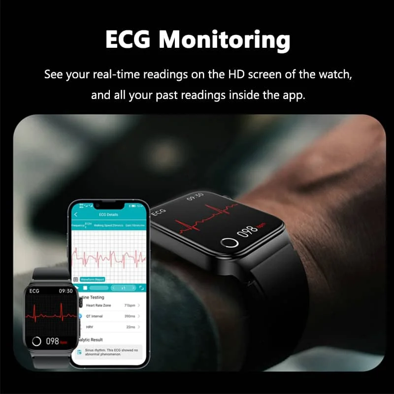 ECG Smart Watch with Blood Pressure Monitor – Health Tracker for Heart Rate, Blood Oxygen & Glucose Monitoring